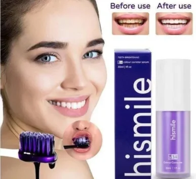 Hismile V34 Colour Corrector Teeth Whitening Serum with Before and After Results